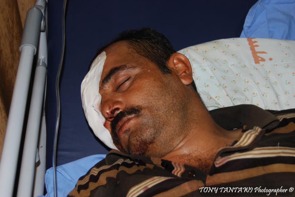 الإعتداء بالضرب المبرح على المواطن أكرم تيسير عودة | صور